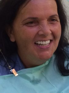 implant fixed teeth