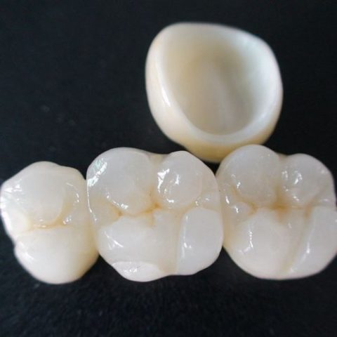 ZIRCONIA CROWNS DENTAL IMPLANT SPECIALITY CENTRE