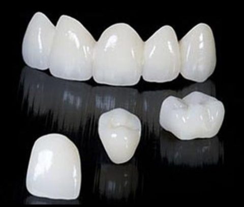 ZIRCONIA CROWNS - DENTAL IMPLANT SPECIALITY CENTRE